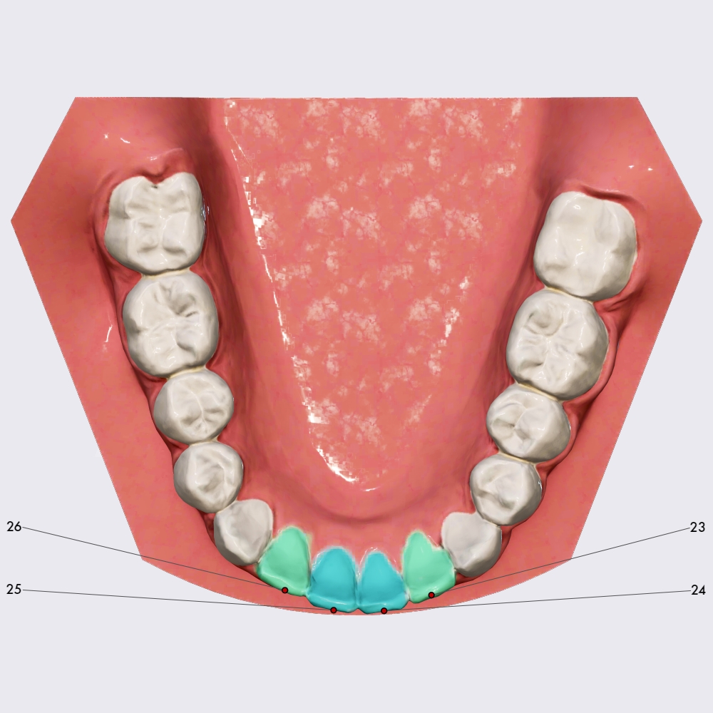 Mandibular incisors