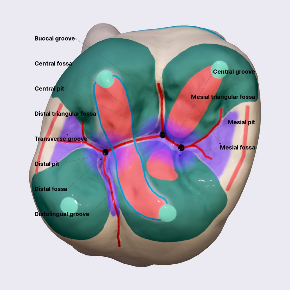 First maxillary molar (part 3)