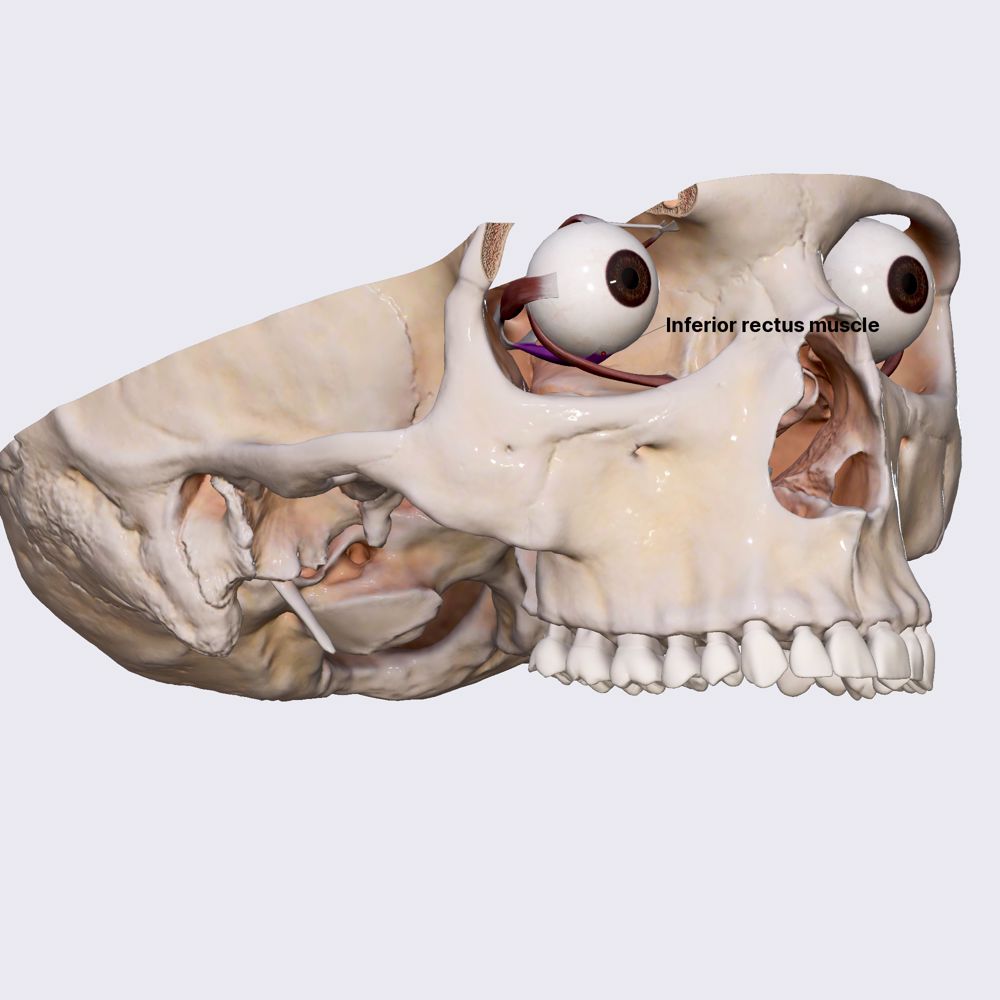 Inferior rectus muscle