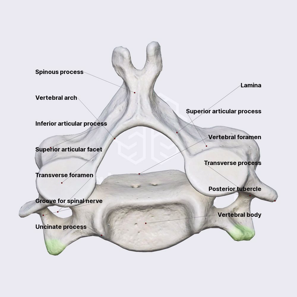 Sixth cervical vertebra (C6)