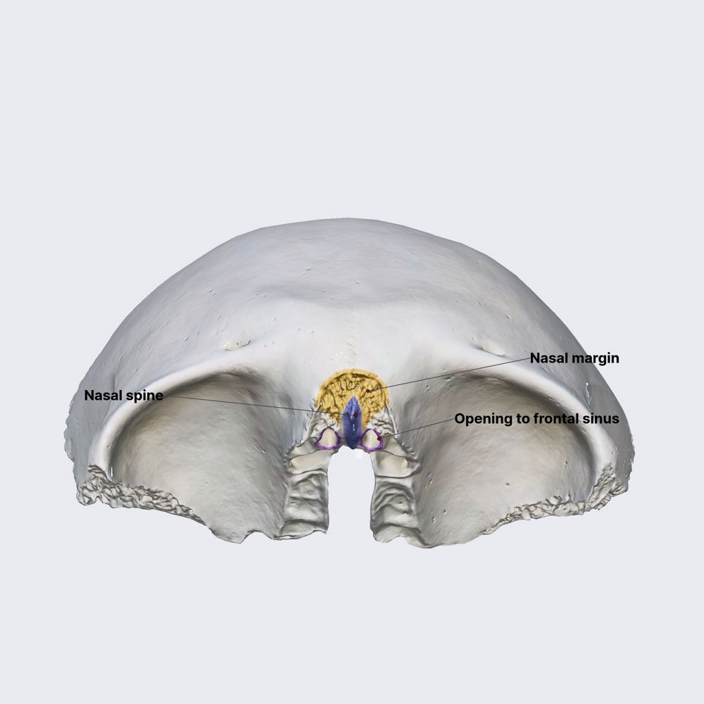 Frontal bone (nasal part)