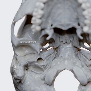 Skull openings image