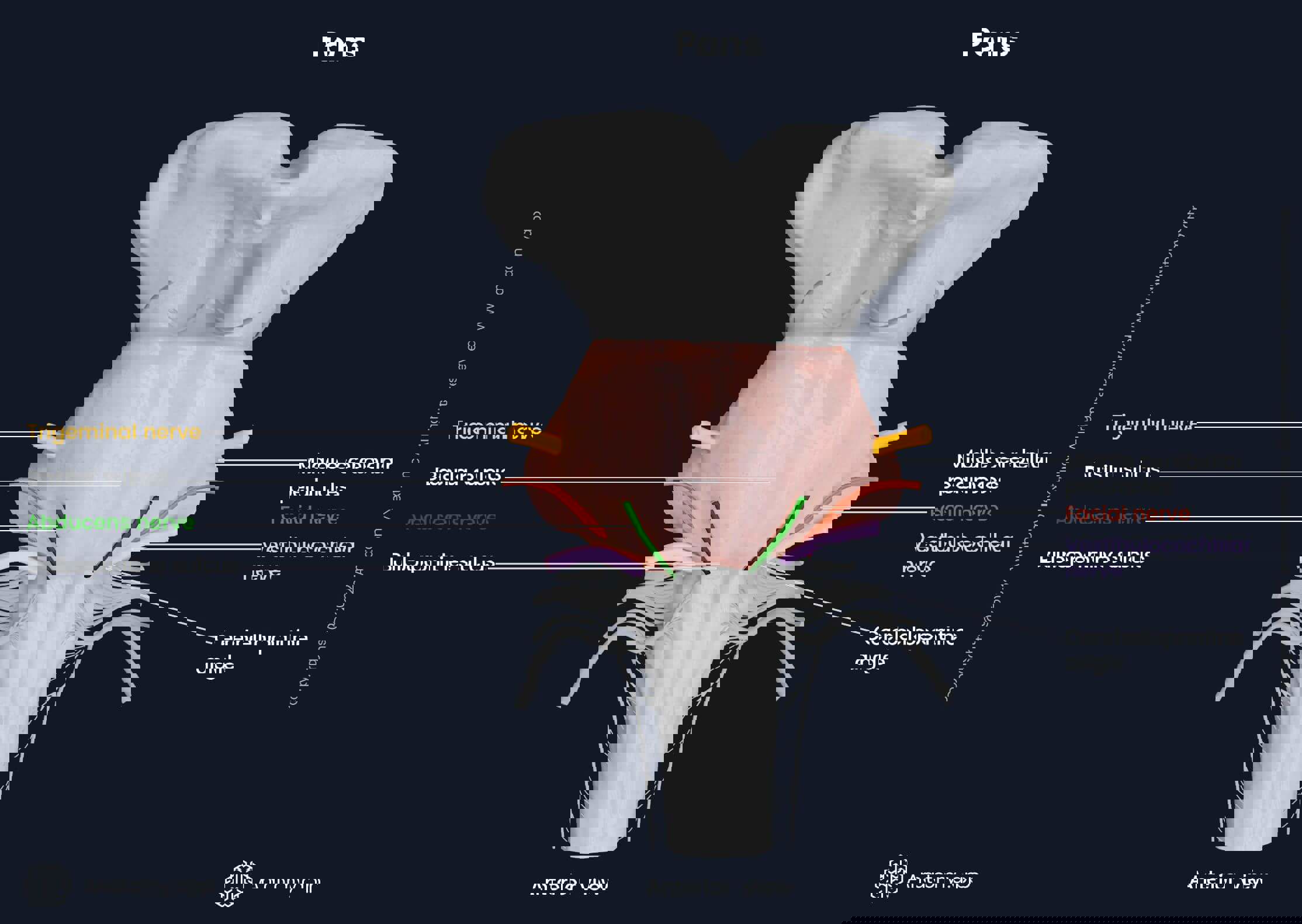 Pons, anterior view, external landmarks and cranial nerve exits